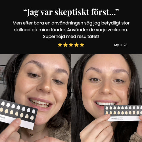 GLACR® | Whitening Strips